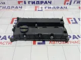 Крышка клапанная Ford Focus 2 5131753
