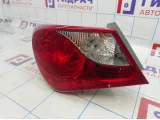 Фонарь задний наружный левый Hyundai Sonata (YF) 92401-3S020
